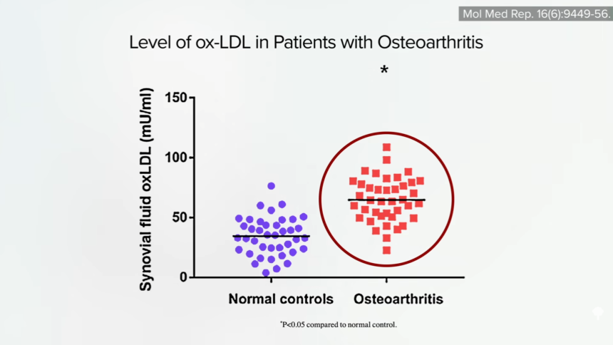 The Best Alternative to Knee Replacement for Osteoarthritis 