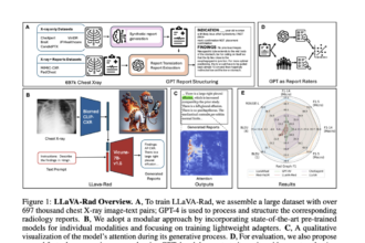 Microsoft AI Researchers Release LLaVA-Rad: A Lightweight Open-Source Foundation Model for Advanced Clinical Radiology Report Generation